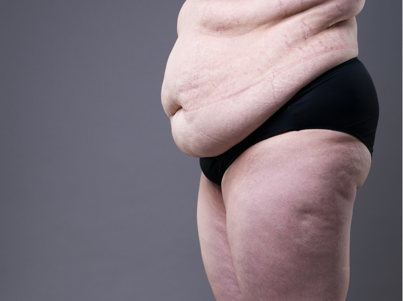 Видео старых толстых баб. Толстое женское тело. Жир у женщин.
