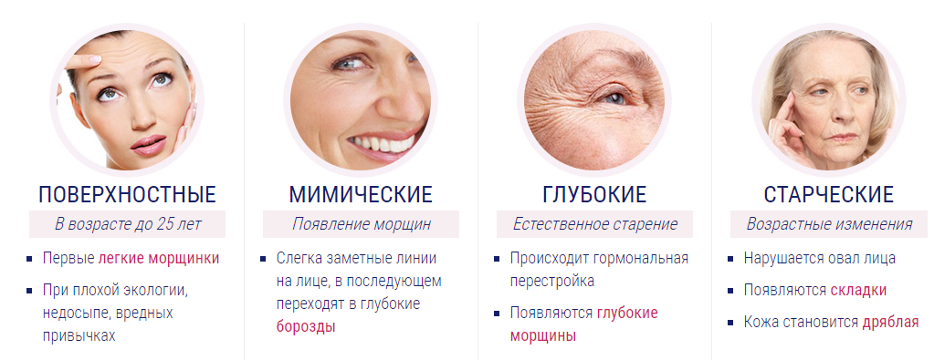 причины появления морщин на лице у женщин